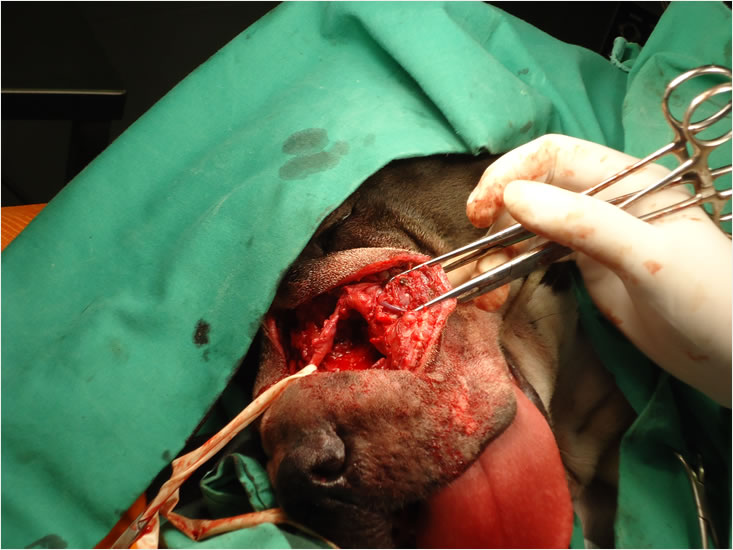Sarcoma in the face extirpation